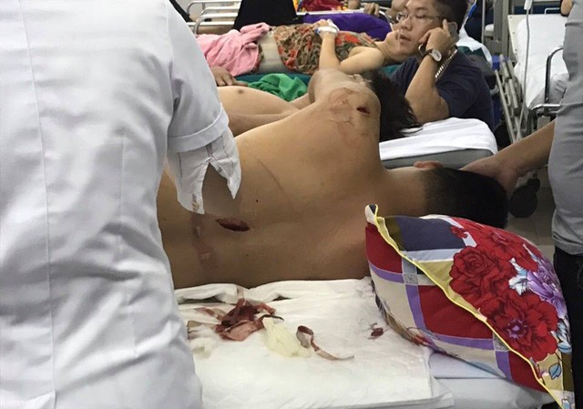 Bị côn đồ bịt mặt truy sát, 9X bị chém hơn chục nhát Nạn nhận bị chém hơn chục nhát