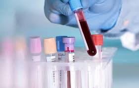 Việt Nam chế tạo thành công Kit phát hiện SARS-Cov-2 đạt chuẩn WHO Việt Nam chế tạo thành công Kit phát hiện SARS-Cov-2 đạt chuẩn WHO