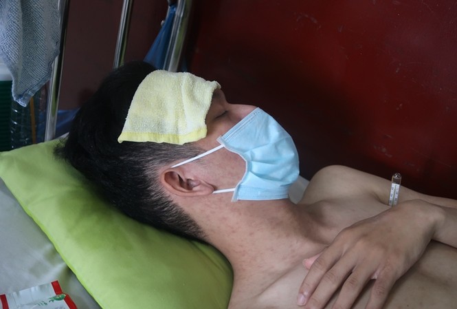 Sởi bùng phát tại TPHCM: Người lớn, trẻ nhỏ ùn ùn nhập viện Sởi bùng phát tại TPHCM: Người lớn, trẻ nhỏ ùn ùn nhập viện
