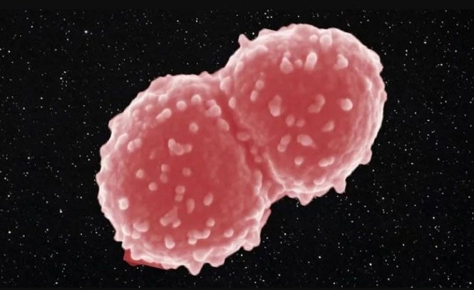 1001 thắc mắc: Loại vi khuẩn nào sống cả năm ngoài vũ trụ? Vi khuẩn Deinococcus radiodurans. Ảnh: Tetyana Milojevic.
