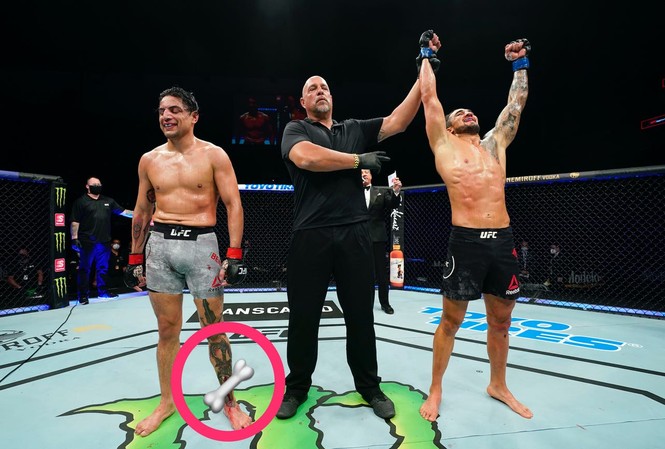 Tăng hạng cân, võ sĩ MMA dính chấn thương kinh dị Gabriel Benitez (trái) chấp nhận thất bại trước Morales.
