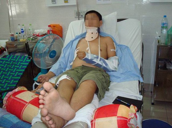 Điều tra vụ côn đồ chém học sinh trọng thương Điều tra vụ côn đồ chém học sinh trọng thương