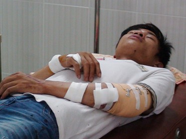 Hai anh em bị chém tới tấp trong quán cà phê Hai anh em bị chém tới tấp trong quán cà phê