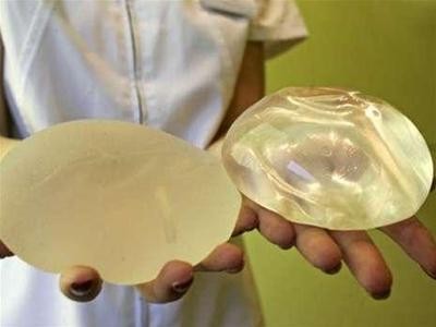10 nghìn phụ nữ TPHCM nâng ngực một năm 10 nghìn phụ nữ TPHCM nâng ngực một năm