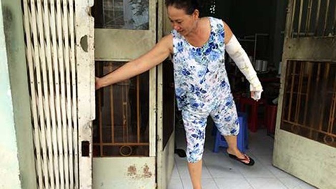 Học sinh truy sát ném nhầm bom xăng vào nhà dân Từ vụ hai nhóm HS va chạm, chị H. bị bỏng nặng cánh tay trái, cửa nhà cùng một số đồ đạc bị cháy xém. Ảnh: TK