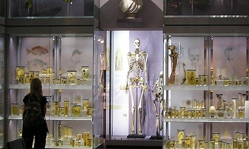 Số phận của hài cốt Người khổng lồ Ireland Bộ xương của Charles Byrne trưng bày trong bảo tàng Hunterian. Ảnh: Science Alert.