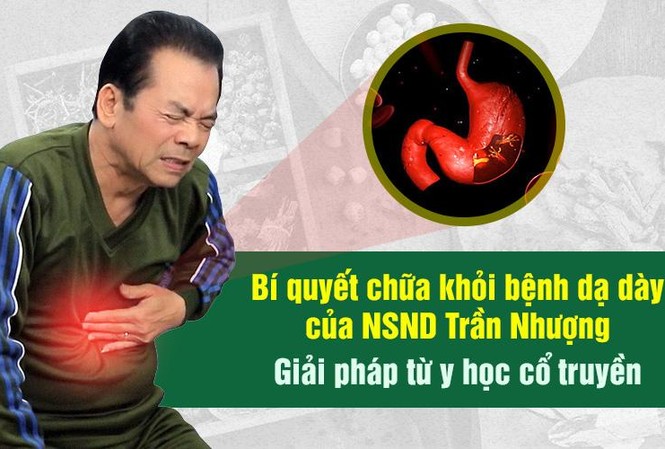 Thuốc dân tộc chữa khỏi bệnh dạ dày cho NSND Trần Nhượng Thuốc dân tộc chữa khỏi bệnh dạ dày cho NSND Trần Nhượng