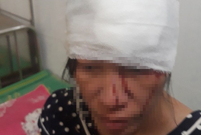 Hai đối tượng xông vào nhà hành hung khiến thai phụ trọng thương Chị Hằng khi mới được đưa đi điều trị