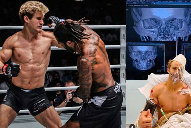 Kinh hãi trước cú đấm cực mạnh khiến võ sĩ Mỹ bị rạn xương mặt Sage Northcutt phải nhập viện vì bị đối thủ đấm rạn xương mặt.