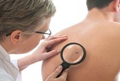 9 điều nên và không nên làm để giảm nguy cơ mắc ung thư 9 điều nên và không nên làm để giảm nguy cơ mắc ung thư