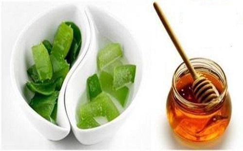 2 phương pháp chữa u nang buồn trứng giai đoạn đầu Ảnh minh hoạ: Internet