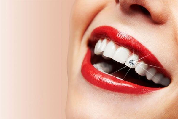 Thực phẩm cho răng trắng bóng, chắc khỏe Ảnh minh họa: Internet