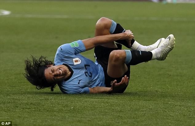 Uruguay có thể mất 'trọng pháo' Cavani trận gặp Pháp Cavni dính chấn thương trọng trận đấu gặp Bồ Đào Nha