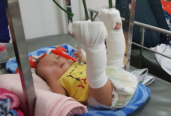 Lời khai của người đánh con 4 tháng tuổi xuất huyết não, gãy 2 chân Bé trai bị bố bạo hành chấn thương nặng.