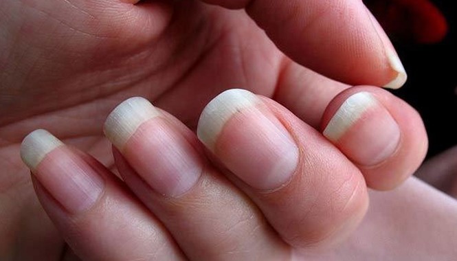 Nguyên nhân móng tay mọc nhanh hơn móng chân Móng tay có thể phát triển nhanh hơn so với móng chân tùy theo đặc điểm giới tính, chế độ ăn uống hay di truyền. (Ảnh minh họa: Flickr)