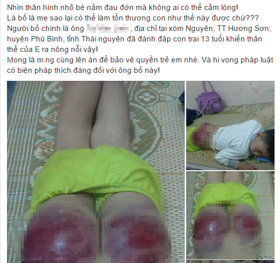 Bố đánh con tứa máu: 'Tôi chấp nhận tiếng ác để dạy con' ảnh 1
