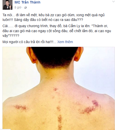 Trấn Thành nói Hari Won cạo gió như mèo cào ảnh 1