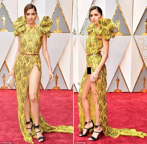 Những ‘thảm họa’ thời trang tại Oscar 2017 ảnh 5