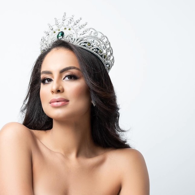 Ảnh bán nude nóng 'bỏng rẫy' khác lạ của Tân Hoa hậu Trái đất ảnh 1