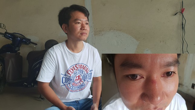 Vụ dân tố bị 'người lạ' hành hung: CSGT TPHCM nói gì? ảnh 2