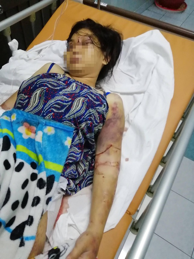 Vụ cô gái 18 tuổi bị tra tấn đến sẩy thai: Bắt tạm giam một đối tượng ảnh 1