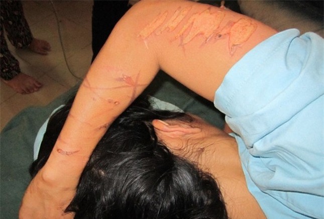 Những vụ dùng 'nhục hình' dã man như thời trung cổ ảnh 2