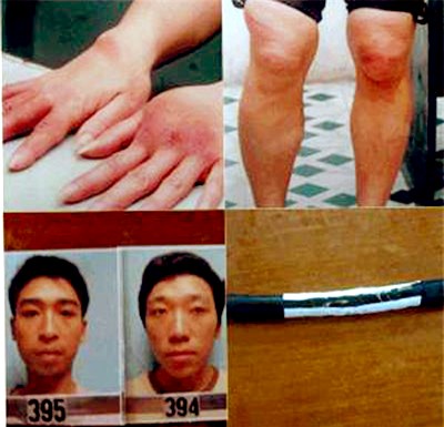 Những vụ dùng 'nhục hình' dã man như thời trung cổ ảnh 5