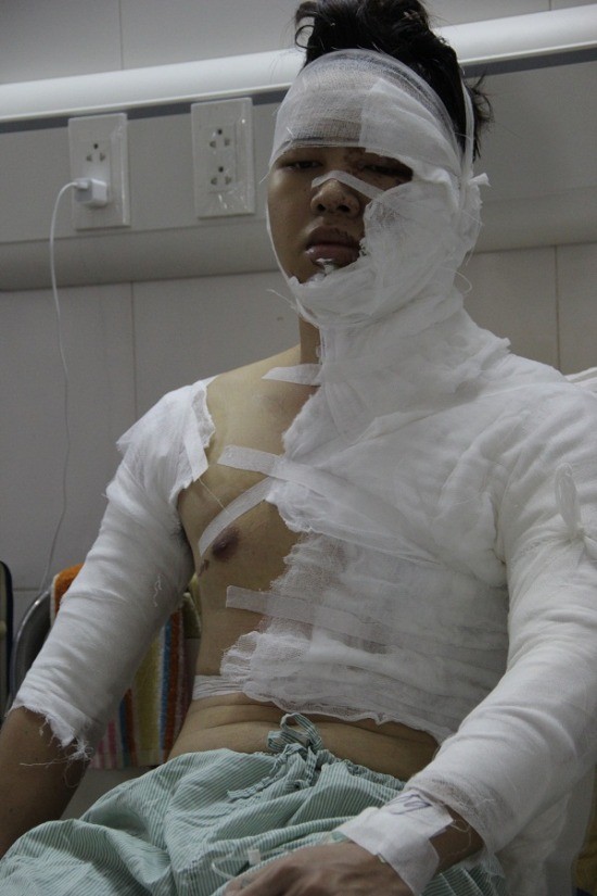 Nam sinh ĐH Sân khấu Điện ảnh bị 'khủng bố' trước khi bị tạt axit ảnh 1