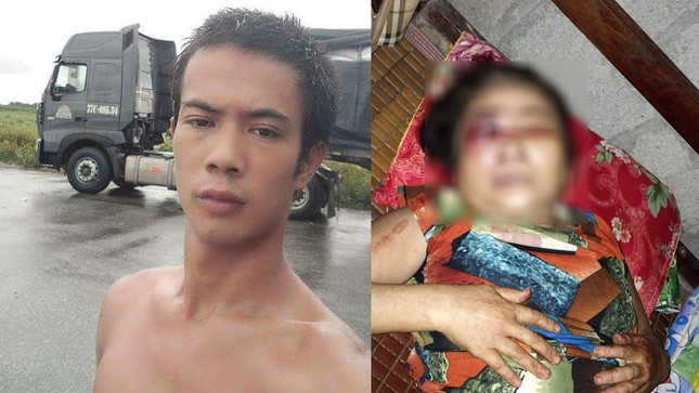 Mâu thuẫn trên chiếu bạc, người phụ nữ bị đánh hỏng mắt ảnh 1