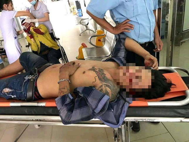 Bị tấn công, bảo vệ móc súng bắn như phim hành động ảnh 1