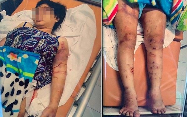 Bắt kẻ cầm đầu vụ tra tấn như thời trung cổ khiến cô gái 18 tuổi sảy thai ảnh 1