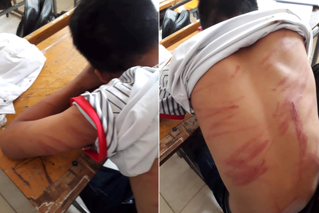 Người bố khai lý do đánh con ngất xỉu phải nhập viện ảnh 1