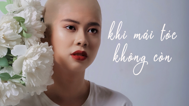 Dự án “Khi mái tóc không còn“ ảnh 1