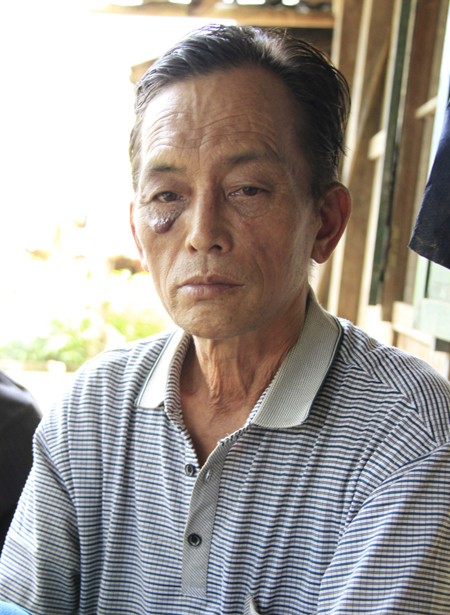 Chuyện kể ở "cánh đồng ma" ảnh 2