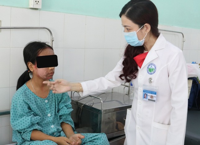Thiếu nữ 17 tuổi hỏng mặt do dùng mỹ phẩm lột trắng da ảnh 2