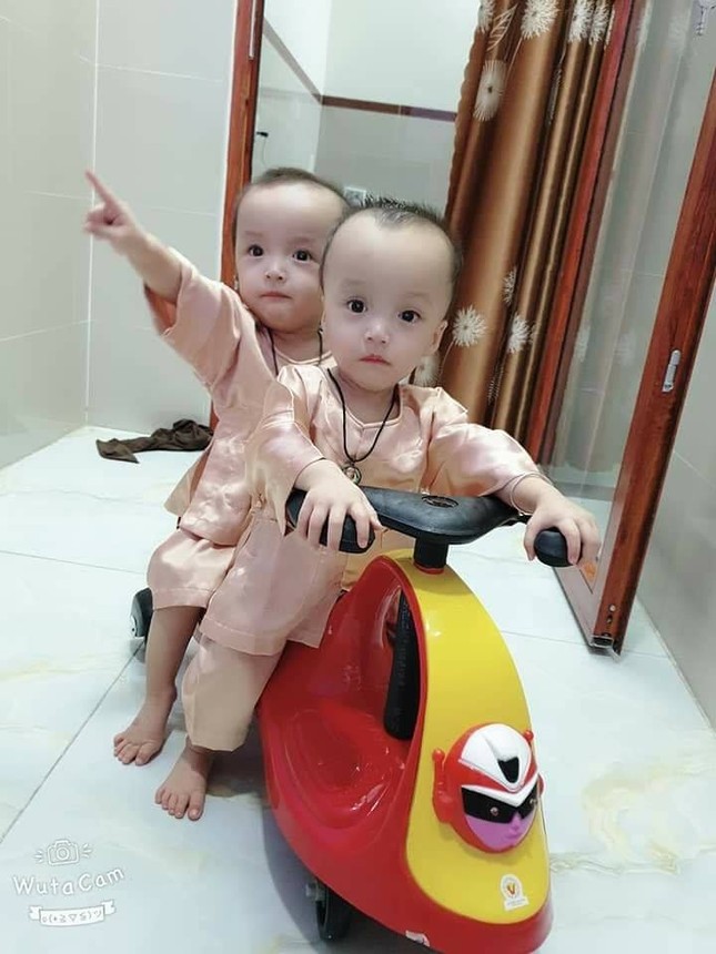 Song Nhi đến viện tái khám, thích thú trổ tài 'đua xe' ảnh 1