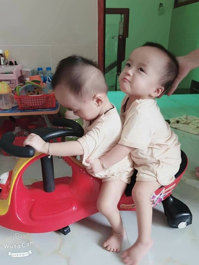 Song Nhi đến viện tái khám, thích thú trổ tài 'đua xe' ảnh 2