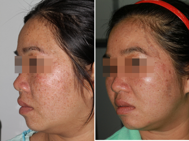 3 người trong một gia đình mang gen đột biến ‘chỉ sống được về đêm’ ảnh 1