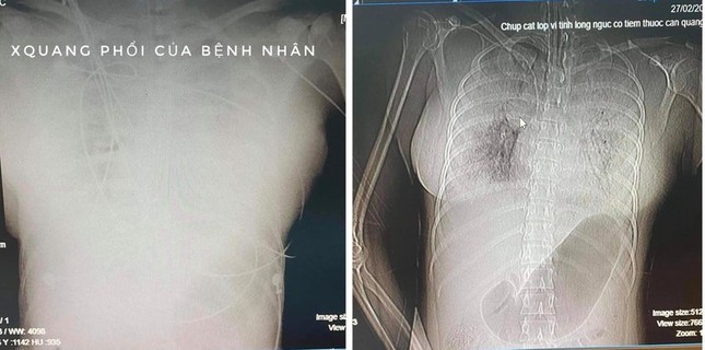 TPHCM: Người phụ nữ trẻ tử vong bất thường sau khi nâng ngực ảnh 1