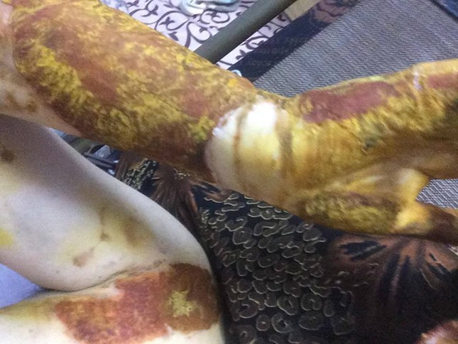 Admin diễn đàn đưa chuyện nữ sinh bỏng nặng đăng tút “xuống chức” ảnh 1