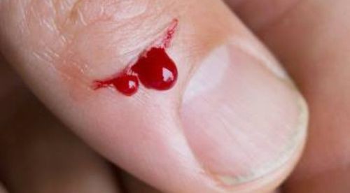 Tránh xa gừng nếu bạn mắc các bệnh sau kẻo ‘hối không kịp’ ảnh 1