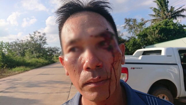 Vừa tố cáo cán bộ địa chính nhận hối lộ, một người dân bị đánh rách mặt ảnh 2