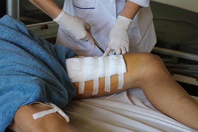 Bình rượu 20 lít phát nổ, người đàn ông bị đứt cơ chân ảnh 1