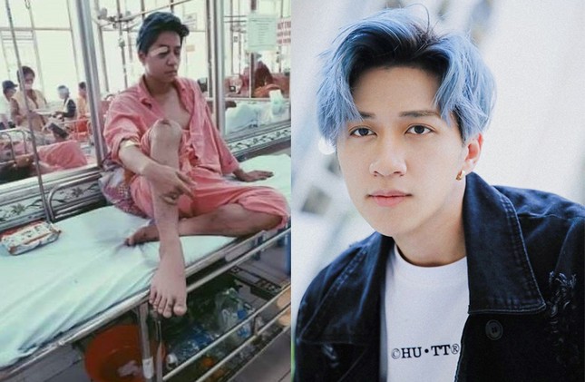 Showbiz 19/5: Nam ca sĩ bị tai nạn, chấn thương sọ não và liệt nửa mặt ảnh 1