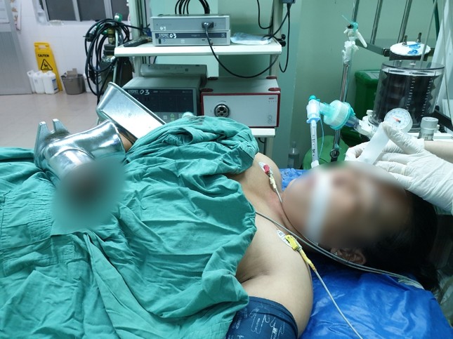 Người phụ nữ bị xay nát cả bàn tay trong máy làm chả cá ảnh 1