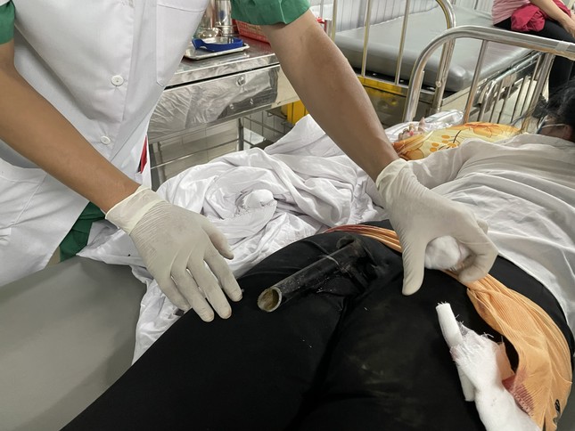 Va chạm giao thông, cô gái bị chân chống xe máy đâm dính vào vùng mông ảnh 1
