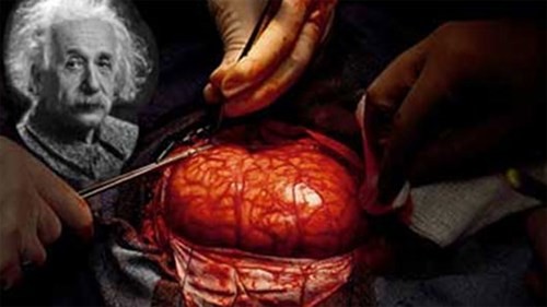 Chuyện lạ có thật về bộ não con người ảnh 1