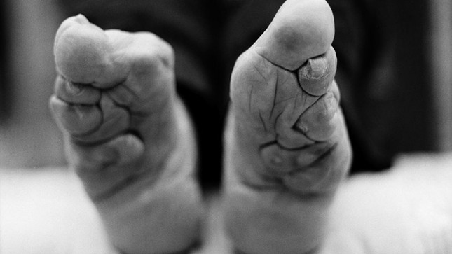 Những nhân chứng sống cuối cùng của tục bó chân ảnh 3
