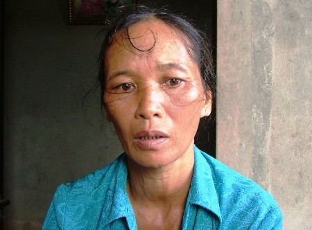 Mắc bệnh lạ, chàng sinh viên quanh năm chỉ... húp cháo ảnh 4