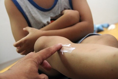 Bộ Y tế hướng dẫn cách phòng virus Zika ảnh 1